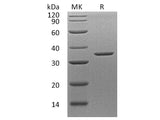 Recombinant Human Annexin A8/ANXA8 Protein