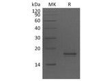 Recombinant Human AGR2 Protein (His Tag)