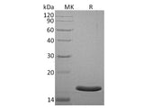 Recombinant Human AGR3 Protein (His Tag)