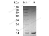 Recombinant Human Apolipoprotein C-II/APOC2 Protein (His Tag)