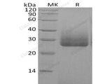 Recombinant Human Apolipoprotein D/ApoD Protein (His Tag)