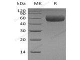 Recombinant Human Apolipoprotein H/ApoH Protein (His Tag)