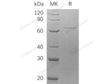 Recombinant Human AIFM1 Protein (His Tag)