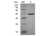 Recombinant Human APE1/APE Protein