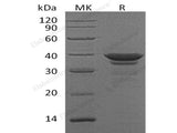 Recombinant Human Arginase-1/ARG1 Protein (E.coli, His Tag)(Active)