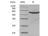 Recombinant Human ASS1 Protein (His Tag)