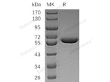 Recombinant Human Arylsulfatase A/ARSA Protein (His Tag)