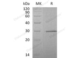 Recombinant Human SWSAP1 Protein (His Tag)