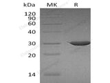 Recombinant Human ABCB5 Protein (Trx Tag)