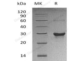 Recombinant Human ATG10 Protein (His&T7 Tag)