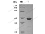 Recombinant Human ATG3 Protein