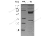 Recombinant Human ATG4A Protein (His Tag)