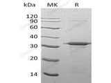 Recombinant Human ATG5 Protein