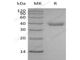 Recombinant Human Azurocidin/CAP37 Protein (His Tag)