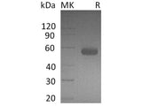 Recombinant Human BTLA/CD272 Protein (Fc Tag)(Active)