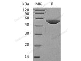 Recombinant Human B4GAT1/B3GNT1 Protein (His Tag)