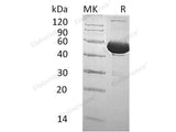 Recombinant Human BPI/CAP57 Protein (His Tag)