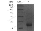 Recombinant Human Survivin/BIRC5 Protein