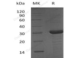 Recombinant Human BCAS2/DAM1 Protein (His & T7 Tag)