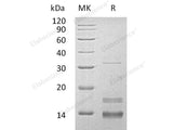 Recombinant Human CD72/Lyb-2 Protein (Trx&His)