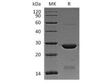 Recombinant Human BAG2 Protein (His Tag)