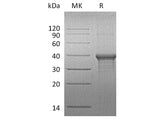 Recombinant Human BLVRA Protein (His Tag)