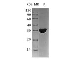 Recombinant Human BPGM Protein (His Tag)