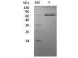 Recombinant Human BMPRIA/ALK-3 Protein (Fc & His Tag)