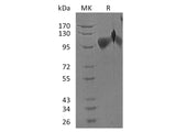 Recombinant Human BMPR2 Protein (Fc & His Tag)