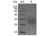 Recombinant Human BOC Protein (His Tag)(Active)