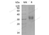 Recombinant Human PRG2/BMPG Protein (His Tag)