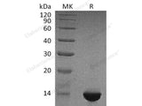 Recombinant Human Brain Natriuretic Peptide/BNP Protein (His & Flag Tag)
