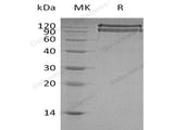 Recombinant Human BAI3 Protein (His Tag)