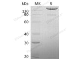 Recombinant Human BCAN Protein (His Tag)