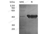 Recombinant Human Bridging Integrator 2/BIN2 Protein (His Tag)