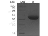 Recombinant Human Butyrophilin 1A1/BTN1A1 Protein (His Tag)