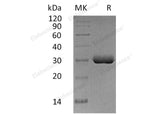 Recombinant Human Butyrophilin 3A2/BTN3A2 Protein (His Tag)