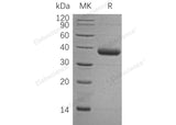 Recombinant Human C1qTNF1/CTRP1 Protein (His Tag)