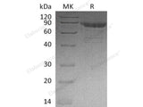 Recombinant Human Cadherin-11/CDH11 Protein (His Tag)