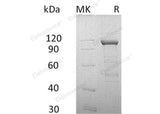 Recombinant Human Cadherin-11/CDH11 Protein (Fc & His Tag)