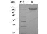 Recombinant Human Cadherin-16/CDH16 Protein (His Tag)