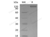 Recombinant Human Cadherin-17/CDH17 Protein (His Tag)