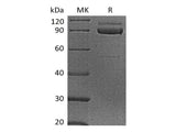 Recombinant Human Cadherin-3/CDH3 Protein (His Tag) 