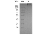 Recombinant Human Cadherin-6/CDH6 Protein (Fc Tag)