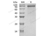 Recombinant Human Cadherin-8/CDH8 Protein (His Tag)