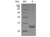 Recombinant Human Calcineurin B/CNB Protein (His Tag)