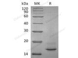 Recombinant Human Calcitonin/CALCA Protein (His Tag)