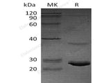 Recombinant Human Calcitonin/CALCA Protein (His Tag, E. coli)