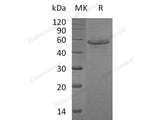 Recombinant Human Calmegin/CLGN Protein (His Tag)