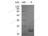 Recombinant Human Calmodulin/CALM1 Protein